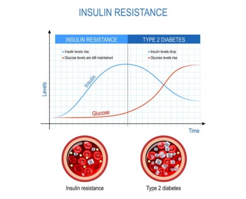 Resistência insulínica no Climatério: Alimentação e Treino Eficazes para Destravar Seu Metabolismo